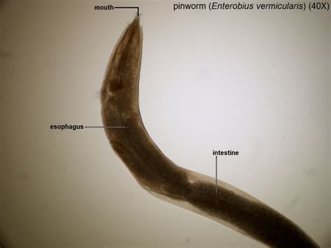 W Enterobius Vermicularis