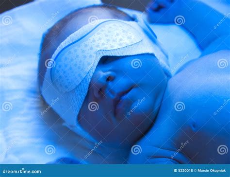 Newborn Jaundice Treatment Royalty Free Stock Photos Image 5220018