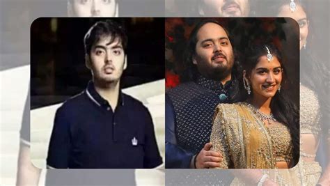 Anant Ambani Regains Weight After Losing 108 Kgs Doctor Explains The