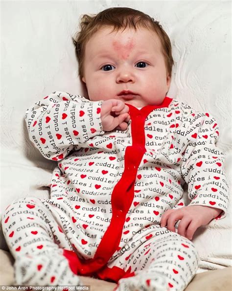 The Adorable Baby With A Heart Shaped Birthmark Born On Valentines Day