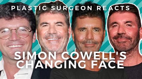 Simon Cowell Plastic Surgery Addicted To Botox Filler Youtube