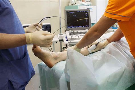 Radiofrequency Ablation For Varicose Veins Vein Clinic Perth