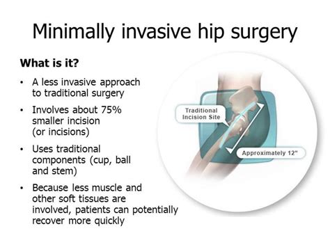 Pin On Minimally Invasive Knee Replacement Los Angeles