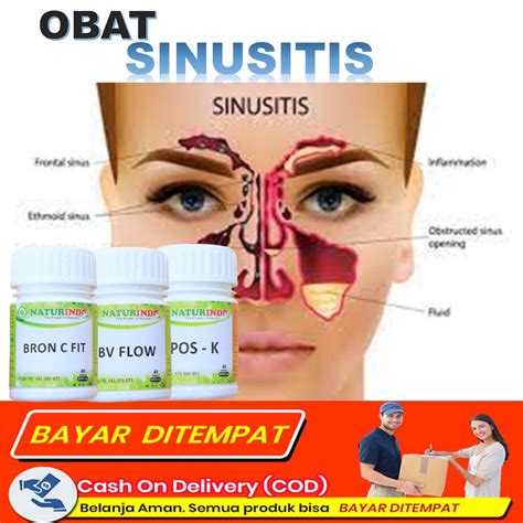 Jual Obat Sinusitis Dan Polip Hidung Menahun Paling Ampuh Herbal Sinus Anak Shopee Indonesia