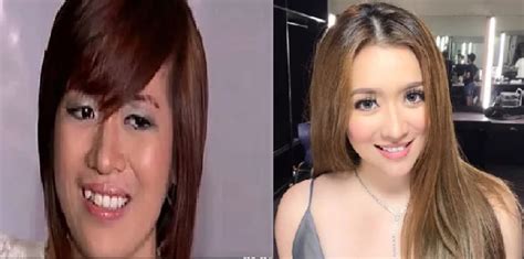 Filipino Celebrities Shocking Transformation After Fame
