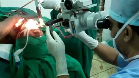 Microlaryngeal Surgery With Laser Drgauri Belsare