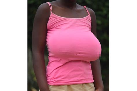 At 15 Her Breasts Are Growing Out Of Control Daily Monitor