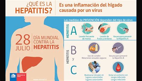 Los Tipos De Hepatitis Y Sus V As De Contagio Salud Peri Dico Z Calo