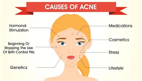 What Is Acne Acne Definition Causes And What Makes It Worse