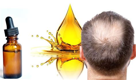 Hair Loss Treatment Cure For Men Try This Essential Oil Blend