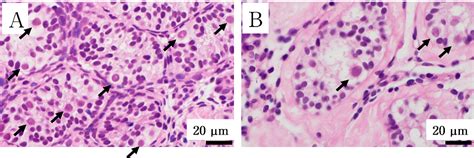 figure 1 from histological analysis of testes in patients with 5 alpha reductase deficiency type