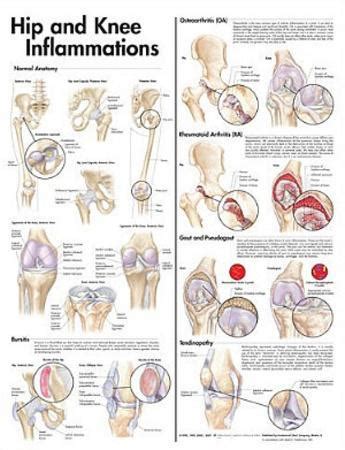 Their predominant function is contractibility. 'Hip and Knee Inflammations Anatomical Chart 2nd Edition ...