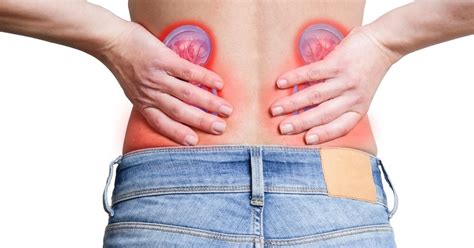 How To Tell The Difference Between Kidney Pain And Lower Back Pain
