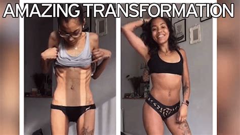 Shocking Pictures Of Anorexic Who Did Sit Ups A Day And Ate Virtually Nothing Irish