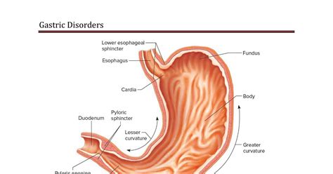 Chronic Peptic Ulcer I Docx Docdroid