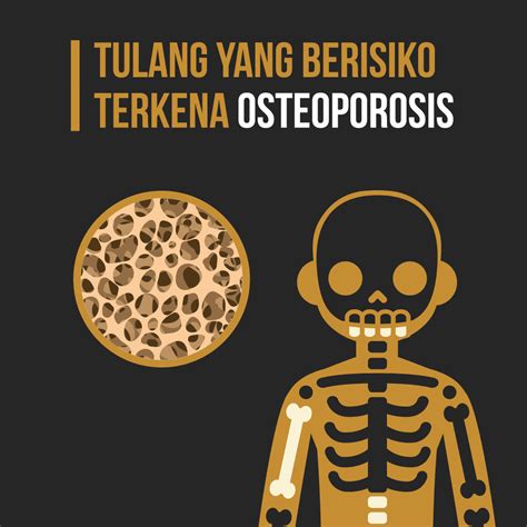 Tulang Yang Berisiko Terkena Osteoporosis Indonesia Baik