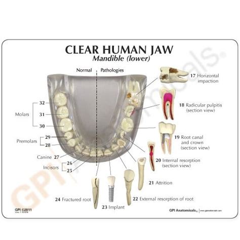 Transparent Jaw With Teeth Model 2861 Clear Model Of Human Jaw