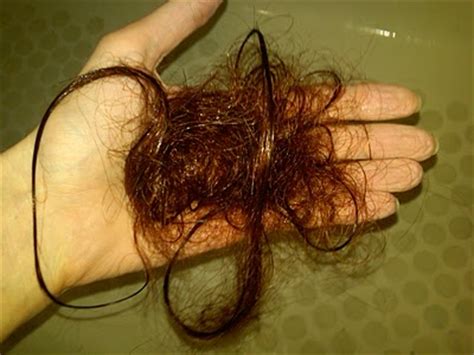 This type of hair loss usually causes overall hair thinning but is temporary. Poo in the pool? 11 of the worst things about going swimming