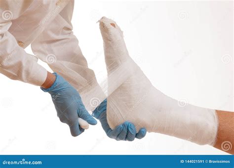 Doctor Broken Leg Health Care Accident Stock Image Image Of Indoors