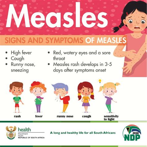 What Are The Signs And Symptoms Of Measles Covid 19 Vaccination Helpdesk