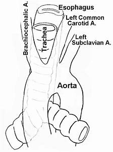Diagram Of Aorta And Trachea