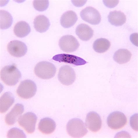 Best Plasmodium Falciparum Images Plasmodium Malaria Medical My XXX