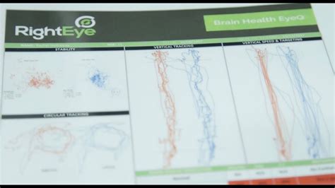 Online eye tracking insights platform. RightEye eye-tracking tests for health - YouTube