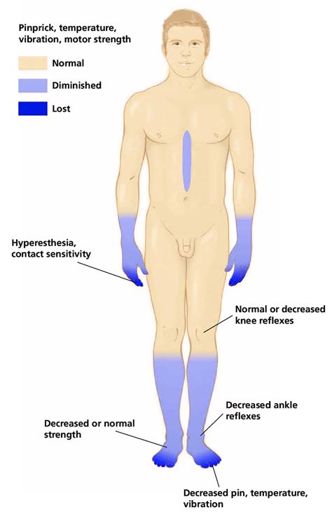 Symptoms Of Chemotherapy Induced Peripheral Neuropathy Adapted From
