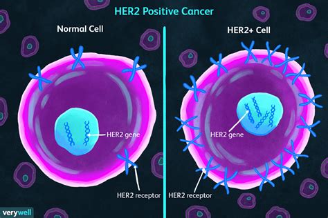 Her2 Positive And Negative Breast Cancers Aggressiveness Treatment
