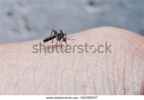 Aedes Mosquito Bite On Skin Mosquito Stock Photo 560380447 Shutterstock