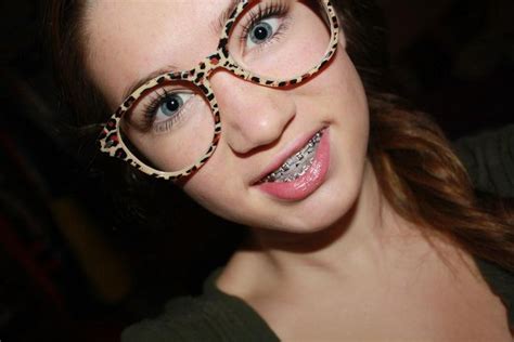 Pin By John Beeson On Girls In Braces Perfect Teeth Cute Frames Glasses