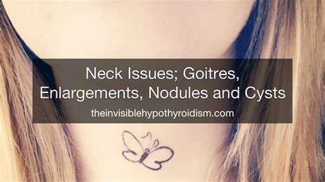 Neck Issues Goitres Enlargements Nodules And Cysts