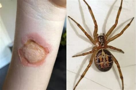 How To Spot The Terrifying Noble False Widow Spiders Sweeping The Uk