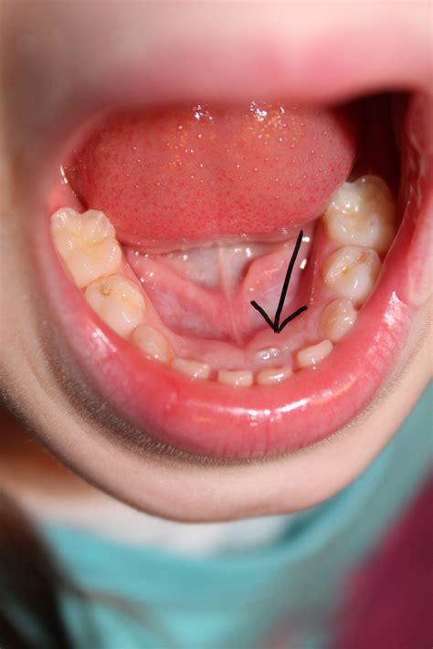Baby Shark Teeth South Court Dental