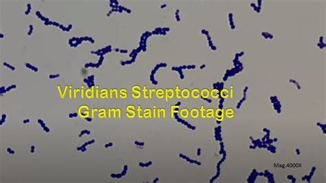 Gram Positive Cocci In Singles Short Chains And Long Chains Of Viridans Streptococci Microscopy