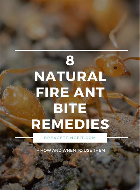 8 Ways To Naturally Treat A Fire Ant Bite Fire Ant Bites Ant Bites