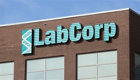 With A 68 Earnings Drop Is Laboratory Corporation Of America