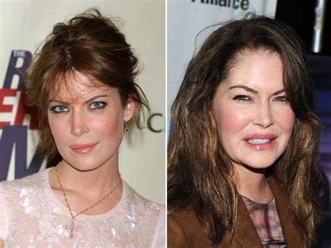 26 Over The Top Hollywood Plastic Surgeries V103 Plastic Surgeries