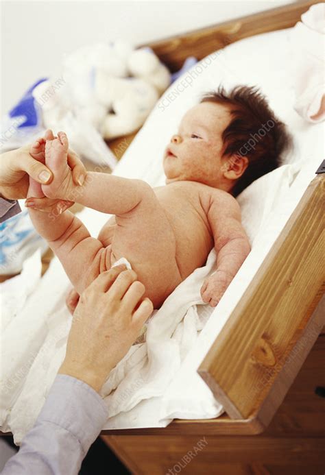 Nappy Changing Stock Image M Science Photo Library