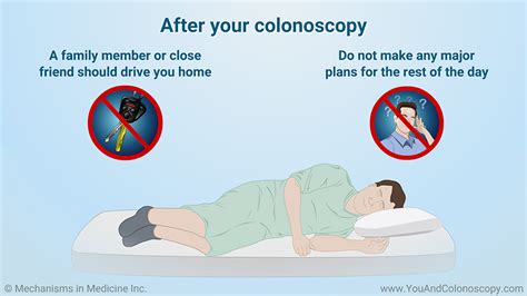 What Happens During And After A Colonoscopy