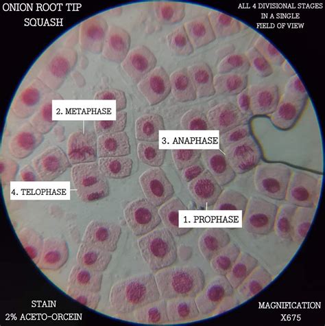 Stages Of Mitosis In Onion Root Tip