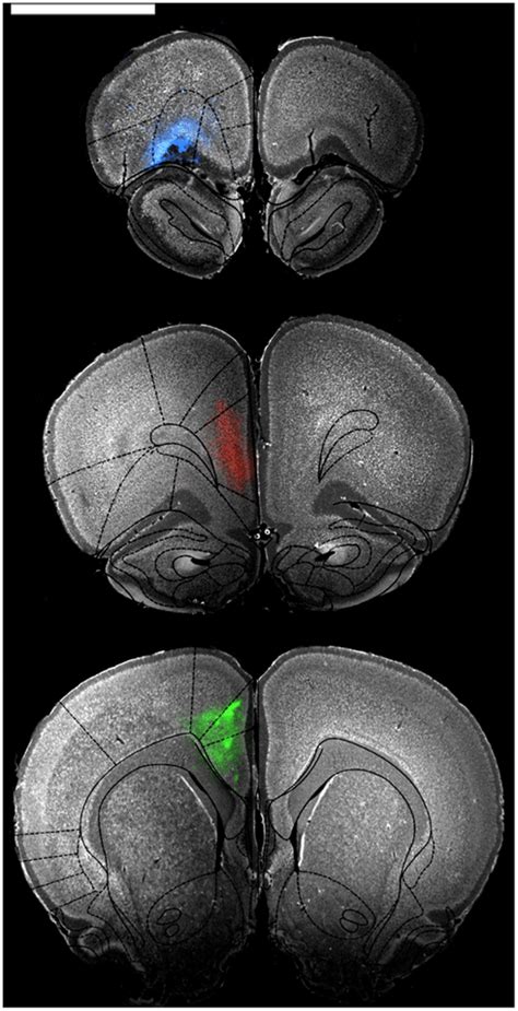 How To Overlay Brain Atlas Outline Onto Brain Slice Image Researchgate