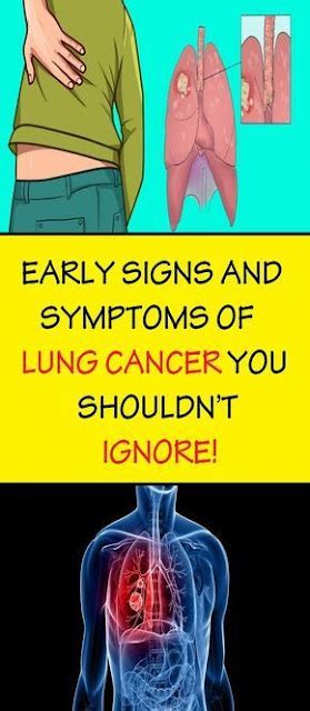Watch Out Early Signs And Symptoms Of Lung Cancer You Shouldnt Ignore