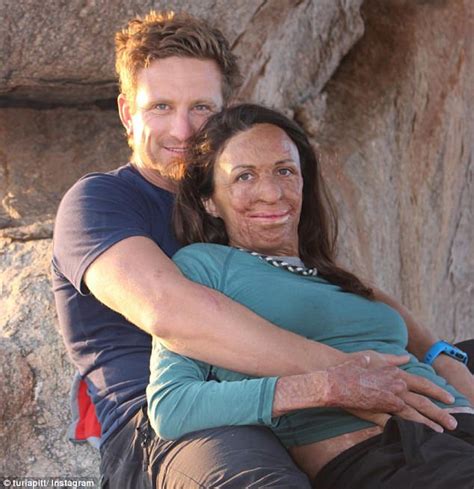 Turia Pitt Shares Sweet Post With Fiance Michael Hoskins Daily Mail Online