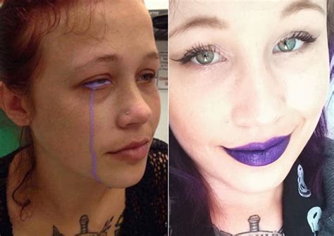 Top 108 Model Goes Blind From Eye Tattoo
