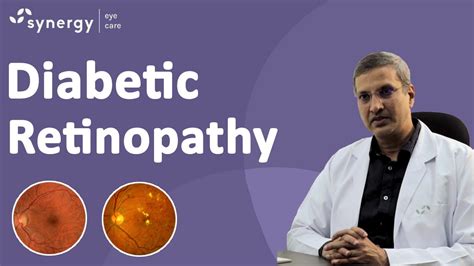 Diabetic Retinopathy Diabetic Retinopathy Symptoms And Treatments