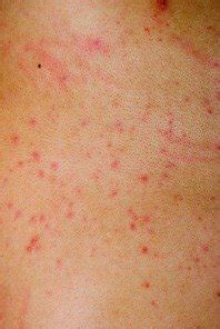 I have hundreds of very very tiny red pinprick dots on my skin. Types of Skin Rashes - Healthy Skin Care
