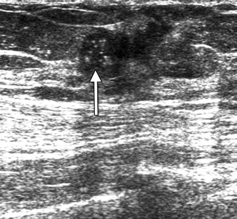 Correlation Between Sonographic Findings And Clinicopathologic And
