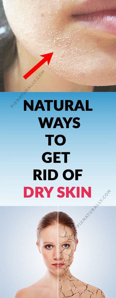 Home Remedies For Dry Skin Dry Skin Natural Dry Skin On Face Dry