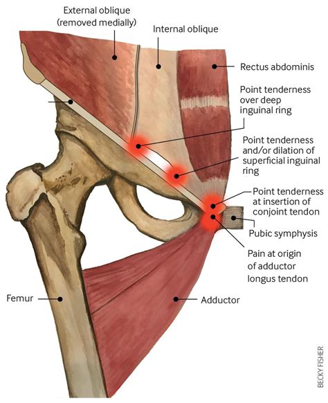 Anatomy Of Groin Muscles